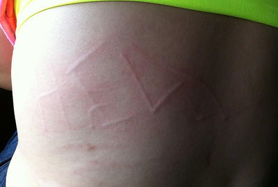 Word manifestation on skin