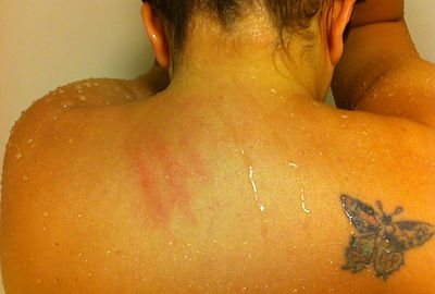Three scratch marks